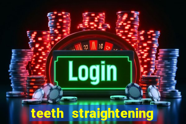 teeth straightening los altos