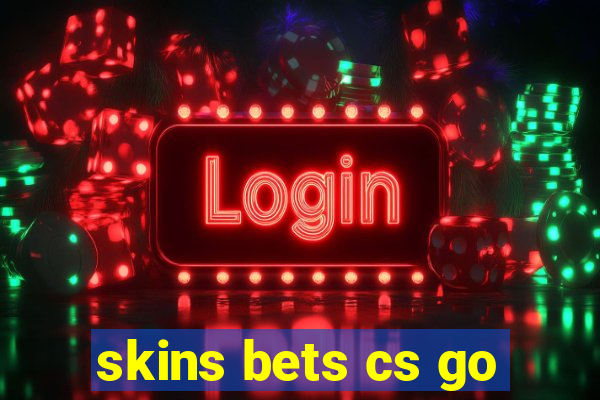 skins bets cs go