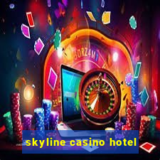 skyline casino hotel